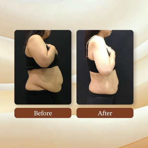 Astra Slimming